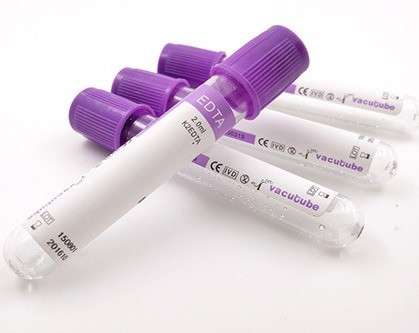 Ống JINGZ 0,5ml-10ml K2 EDTA để thử máu chân không theo độ cao